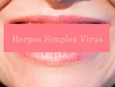Herpes Infection (3)
